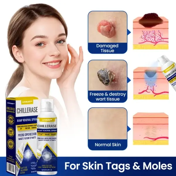 ChillErase Bump Renewal Spray - Image 4