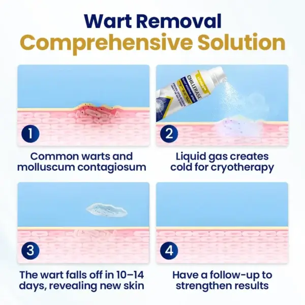 ChillErase Bump Renewal Spray - Image 7