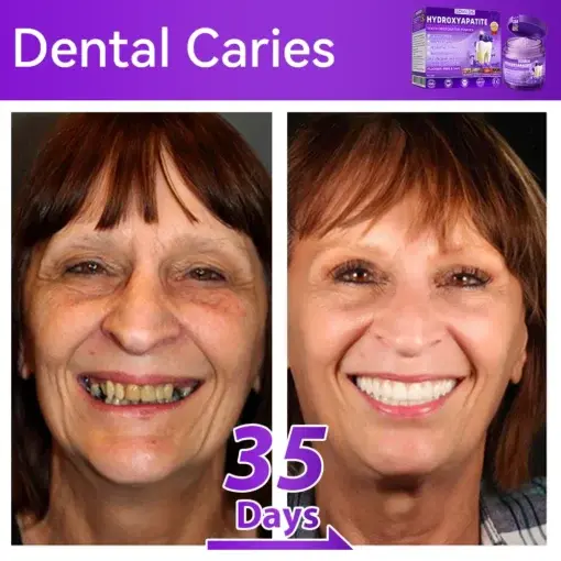 ๐ป๐ฆ๐๐๐๐ฅ๐ฆ๐๐๐๐ก๐๐ก๐ ๐๐๐๐กโ ๐
๐๐ ๐ก๐๐๐๐ก๐๐ฃ๐ ๐๐๐ค๐๐๐ - Image 3