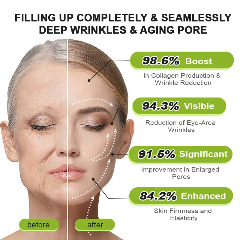 Botox & Vita-A Retinol Shot Tightening and Wrinkle-Reducing Cream - Image 4