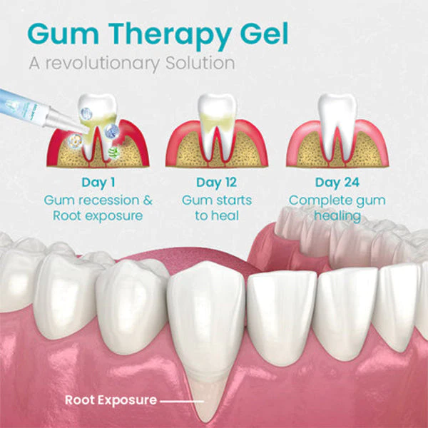 Gum Shield Therapy Gel - Image 5