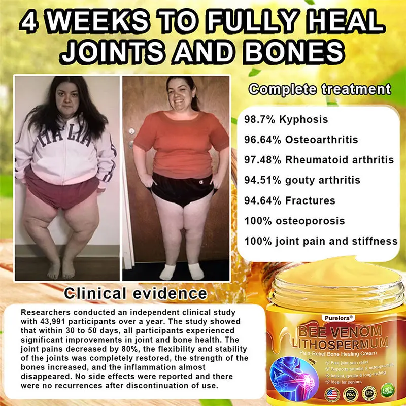 Bee Venom & Lithospermum Comfort Cream - Image 6