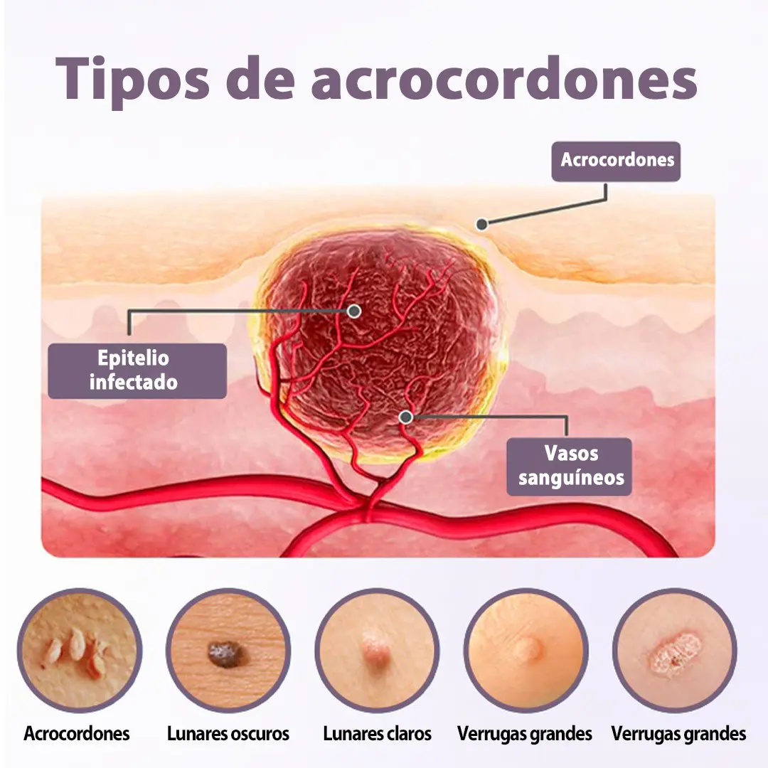 WartSmooth – Sérum Renovador para la Piel - Image 3