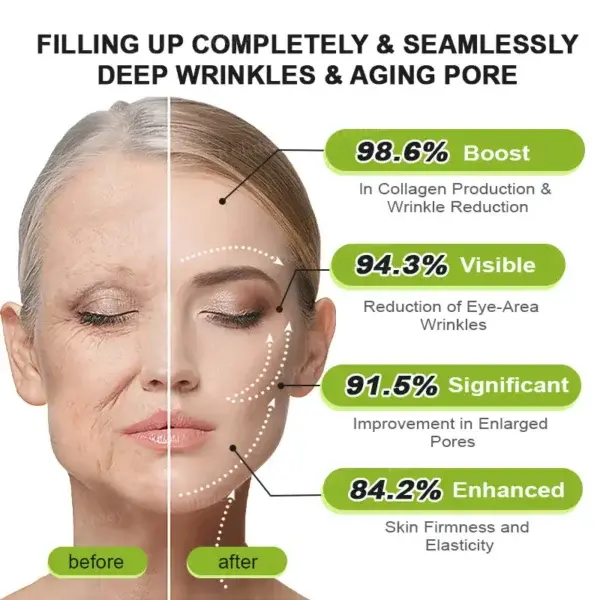 Botox & Vita-A Retinol Shot Wrinkle-Lift Tightening Cream - Image 16