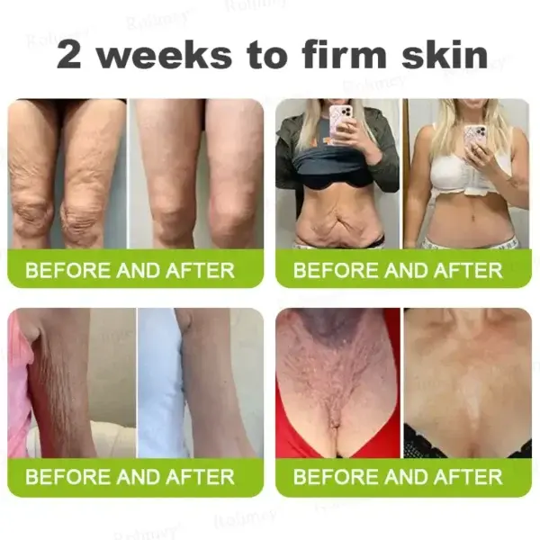 Botox & Vita-A Retinol Shot Wrinkle-Lift Tightening Cream - Image 8