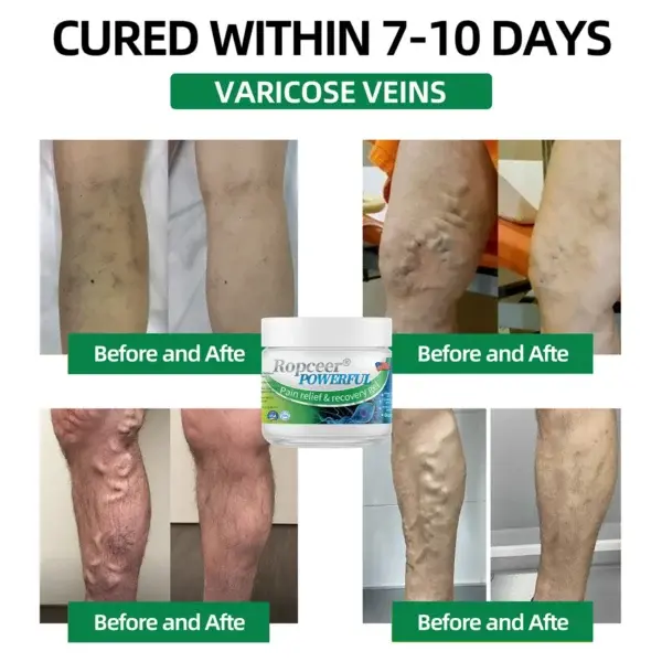 Powerful pain relief& recovery gel - Image 3