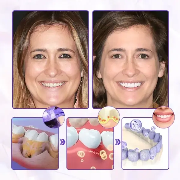 BeeRenew Advanced Gum Regeneration Toothpaste - Image 2