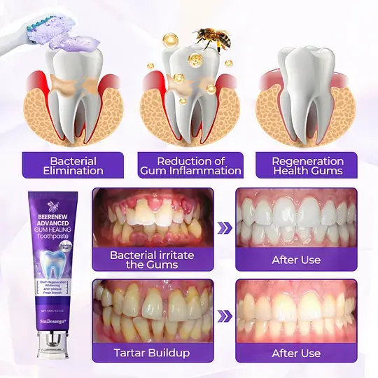 BeeRenew Advanced Gum Regeneration Toothpaste - Image 6