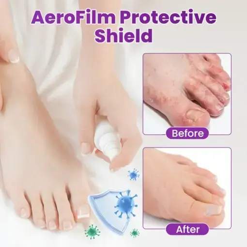 AeroFilm Foot Defense Mist - Image 4