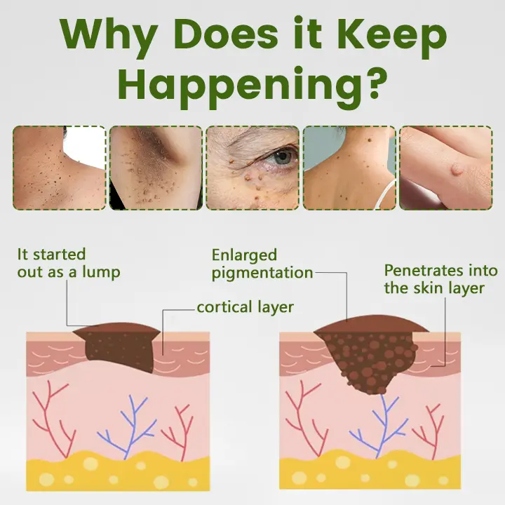 ThujaClear Botanical Wart Cream - Image 2