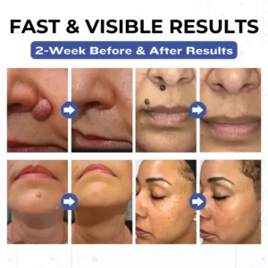 Alternative view of VanishPro Skin Spot Removal Cream