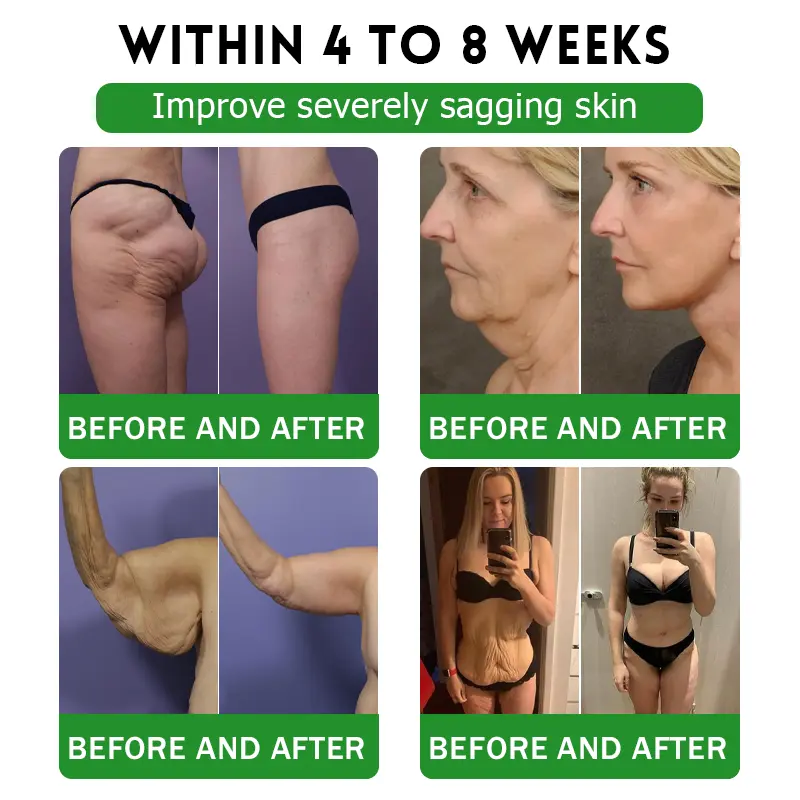 6-๐๐-1 ๐ฏ๐๐๐๐๐ ๐บ๐๐๐๐๐๐๐ ๐ฎ๐๐บ๐
๐๐ข๐ช๐ฎ๐ข๐ย - Image 9