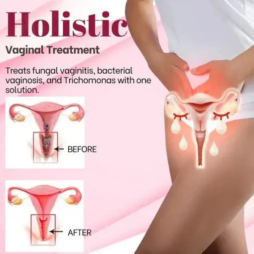 Vaginal Detox Spray - Image 2