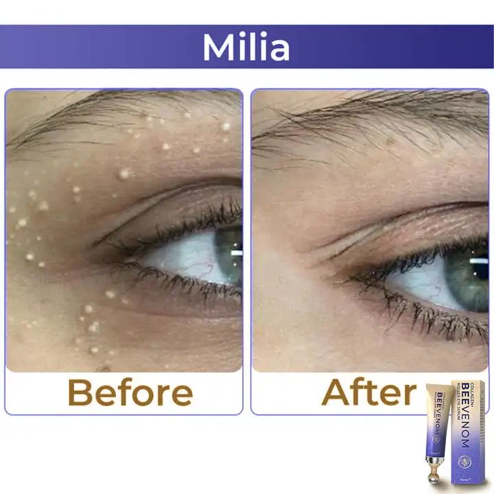 Collagen+ Bee Venom Roller Eye Cream - Image 4