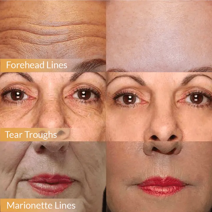 LINE REWIND 24K GOLD SERUM - Image 4