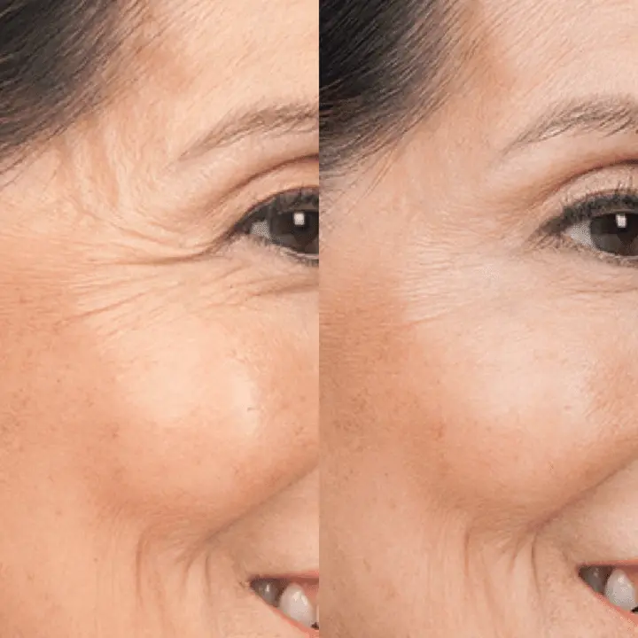 LINE REWIND 24K GOLD SERUM - Image 9