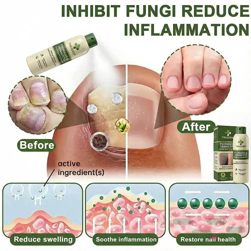 ๐ ๐ฎ๐ด๐ป๐ฒ๐๐ถ๐๐บ ๐๐ฒ๐ฟ๐ฏ๐ฎ๐น ๐ฃ๐๐ผ๐ฟ๐ถ๐ฎ๐๐ถ๐ ๐ฆ๐ฝ๐ฟ๐ฎ๐ - Image 2