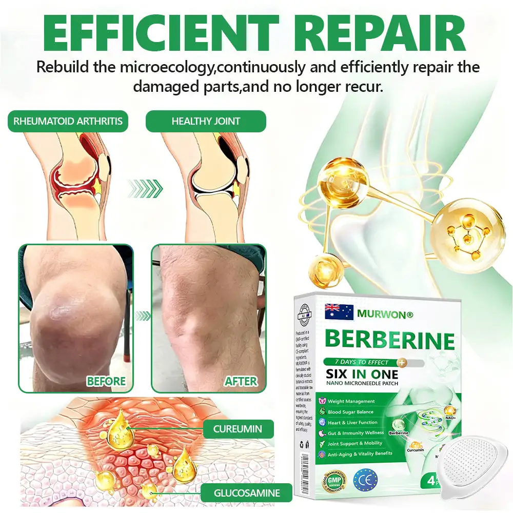 ๐๐ฒ๐ฟ๐ฏ๐ฒ๐ฟ๐ถ๐ป๐ฒ ๐ฒ-๐ถ๐ป-๐ญ ๐ก๐ฎ๐ป๐ผ ๐ ๐ถ๐ฐ๐ฟ๐ผ๐ป๐ฒ๐ฒ๐ฑ๐น๐ฒ ๐ฃ๐ฎ๐๐ฐ๐ต - Image 13