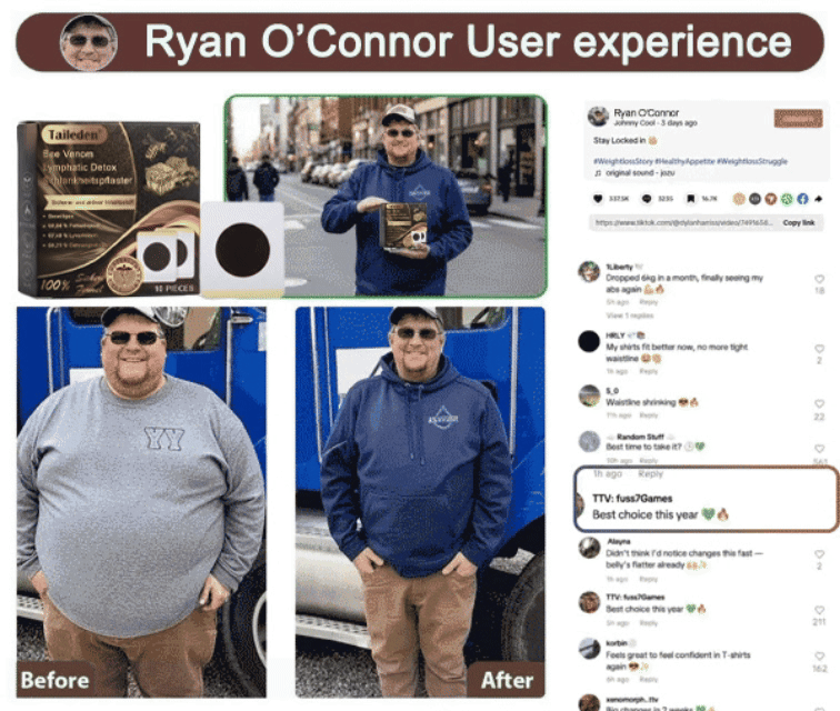 ๐ฑ๐ถ๐ป๐ญ-๐๐ป๐ด๐ฟ๐ฒ๐ฑ๐ถ๐ฒ๐ป๐ ๐ ๐ถ๐ฐ๐ฟ๐ผ๐ป๐ฒ๐ฒ๐ฑ๐น๐ฒ ๐ฃ๐ฎ๐๐ฐ๐ต ๐ณ๐ผ๐ฟ ๐๐ฟ๐ฎ๐๐ถ๐ป๐ด๐ ๐๐ผ๐ป๐๐ฟ๐ผ๐น & ๐ฎ ๐๐ถ๐ฟ๐บ๐ฒ๐ฟ ๐๐ผ๐ผ๐ธ - Image 7