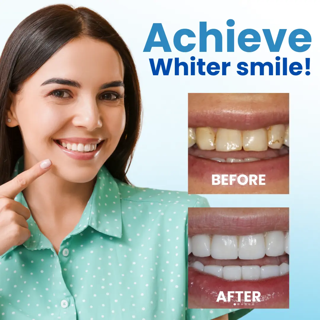 Postbiotics Anti-Plaque Oral Serum - Image 4