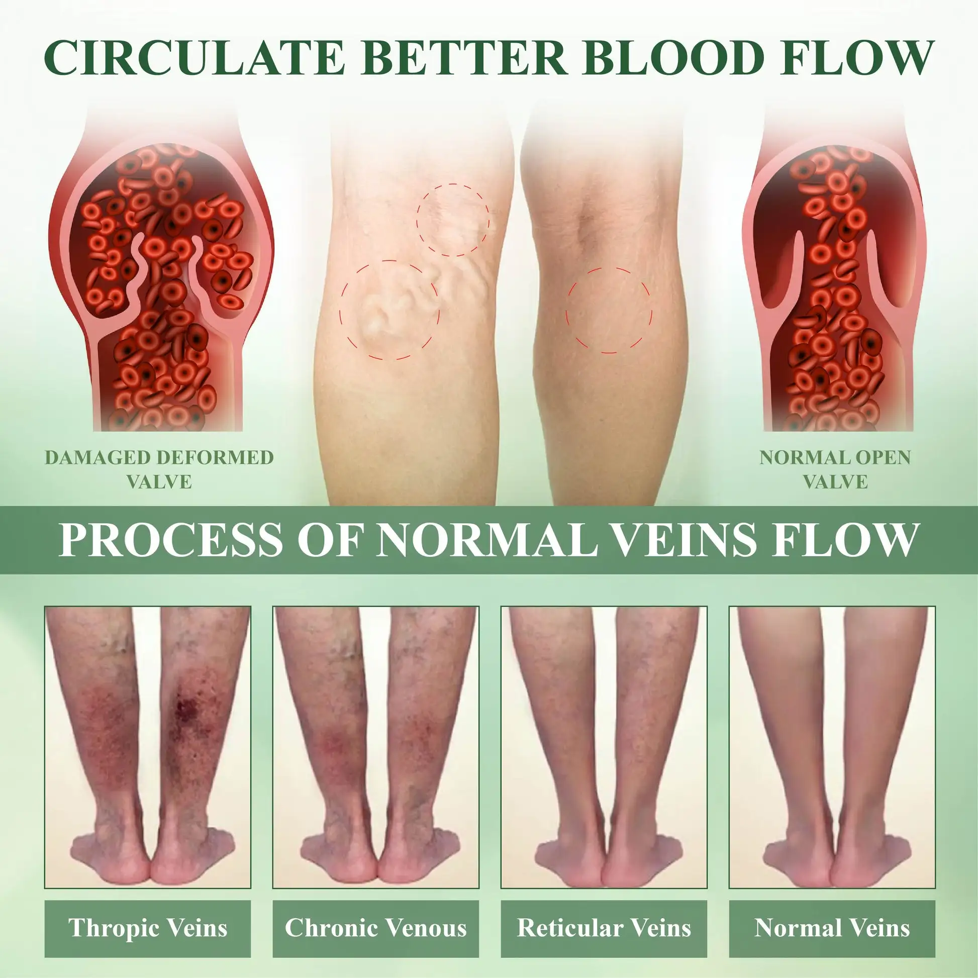 FluidEase Leg Therapy Edema Cream - Image 7