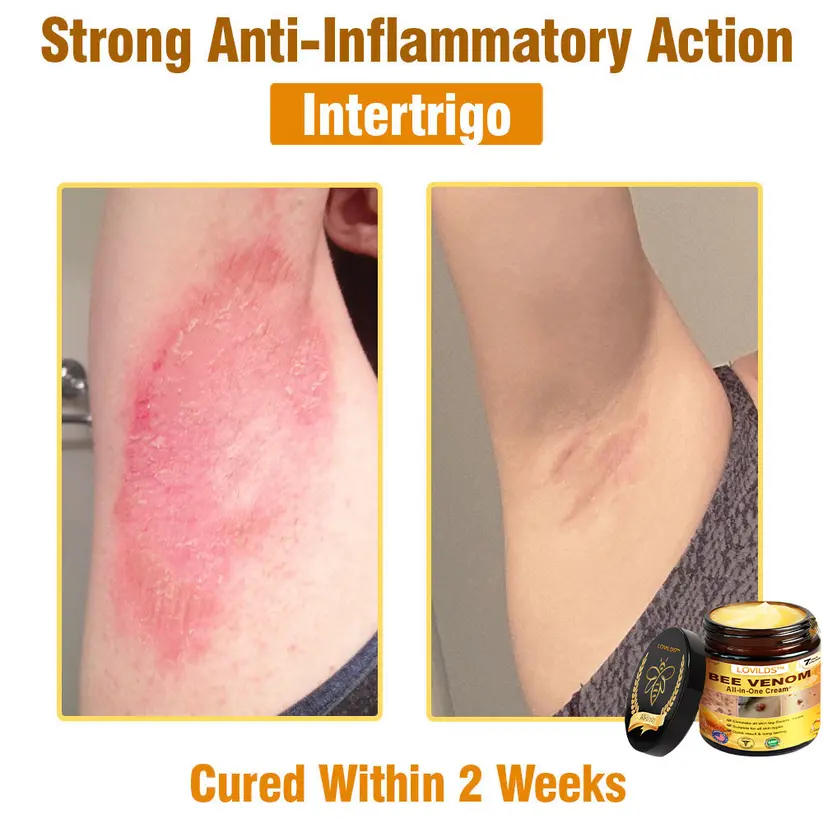 𝐁𝐞𝐞 𝐕𝐞𝐧𝐨𝐦 𝐀𝐥𝐥-𝐢𝐧-𝐎𝐧𝐞 𝐂𝐫𝐞𝐚𝐦 - Image 12