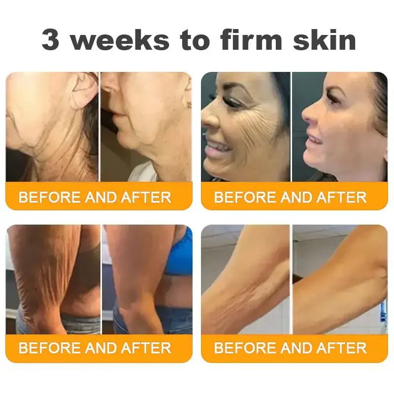 𝐁𝐞𝐞 𝐕𝐞𝐧𝐨𝐦 𝐀𝐥𝐥-𝐢𝐧-𝐎𝐧𝐞 𝐂𝐫𝐞𝐚𝐦 - Image 6