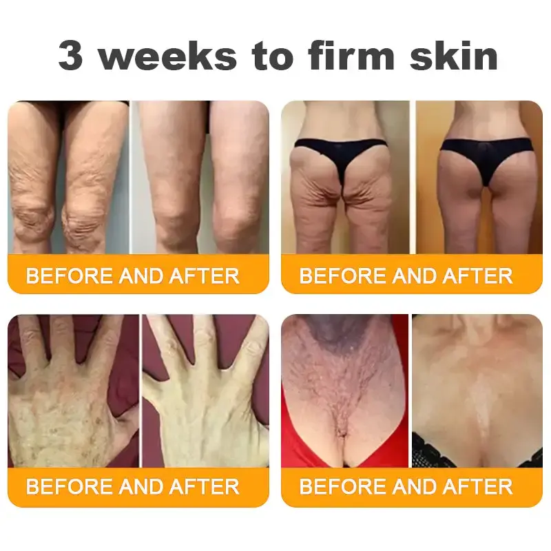 𝐁𝐞𝐞 𝐕𝐞𝐧𝐨𝐦 𝐀𝐥𝐥-𝐢𝐧-𝐎𝐧𝐞 𝐂𝐫𝐞𝐚𝐦 - Image 7