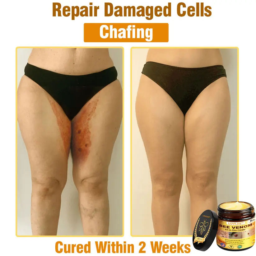 𝐁𝐞𝐞 𝐕𝐞𝐧𝐨𝐦 𝐀𝐥𝐥-𝐢𝐧-𝐎𝐧𝐞 𝐂𝐫𝐞𝐚𝐦 - Image 9