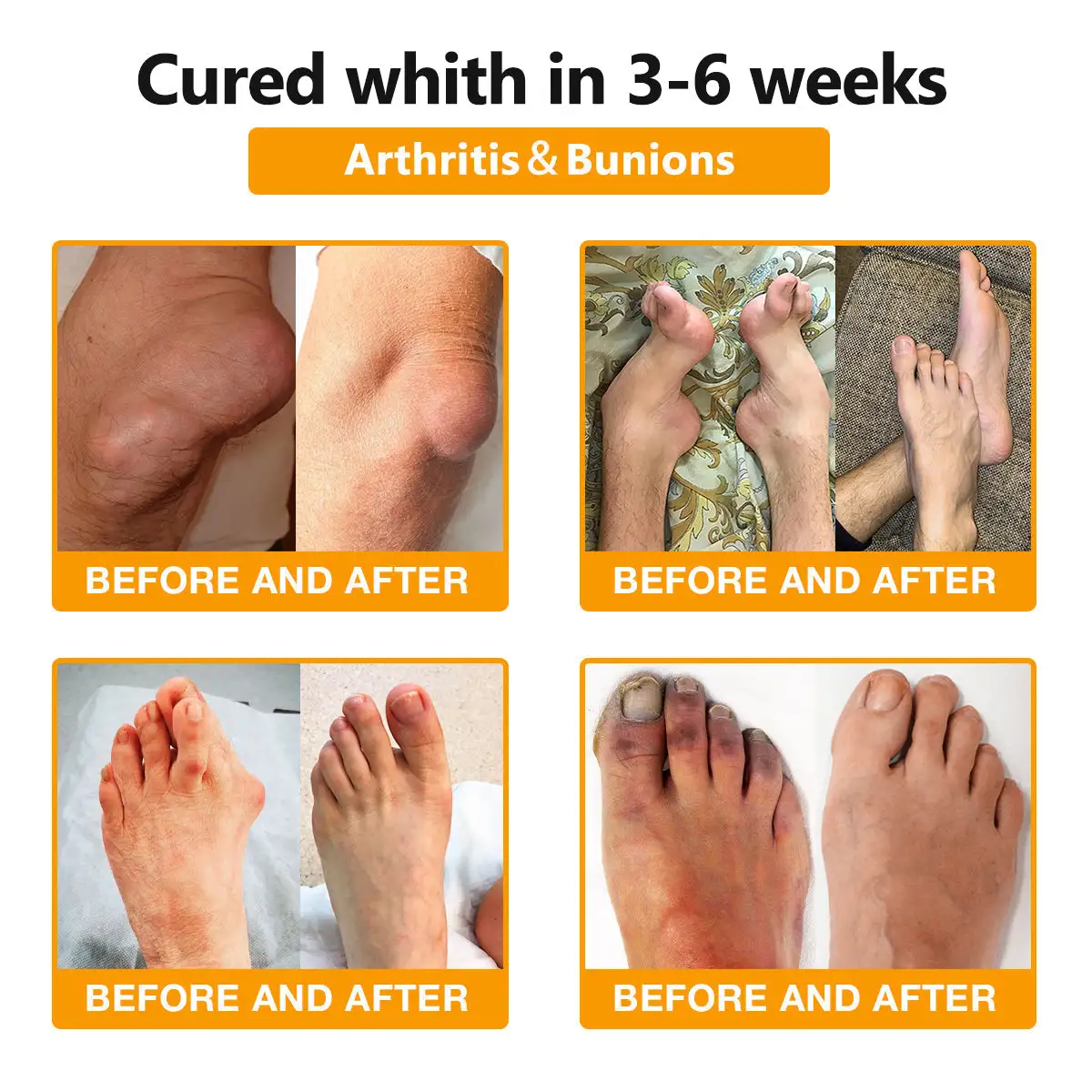 Bee-Venom Pain Relief Bone Healing Cream - Image 2