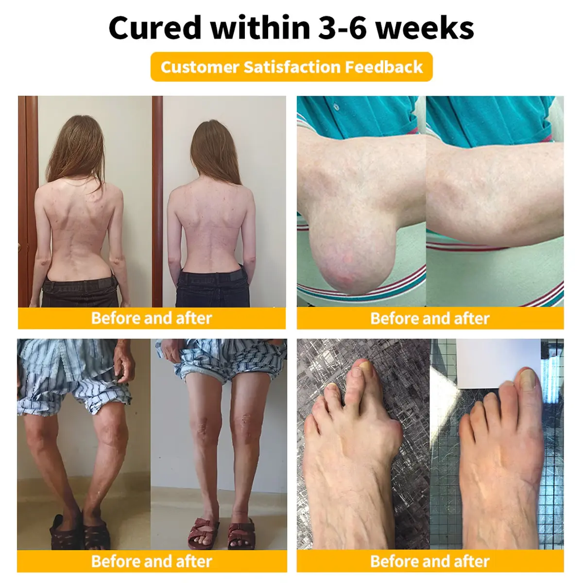 Bee-Venom Pain Relief Bone Healing Cream - Image 4