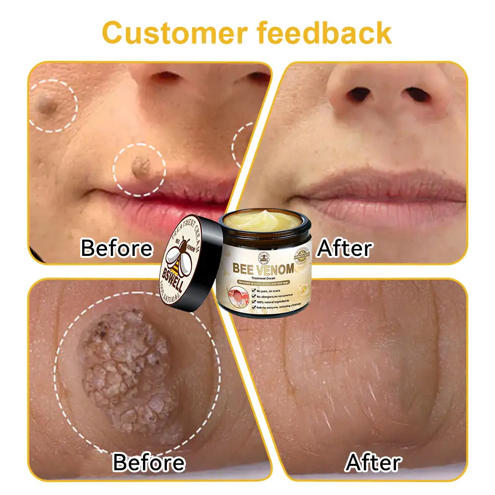 Bee Venom Skin Treatment Cream - Image 5