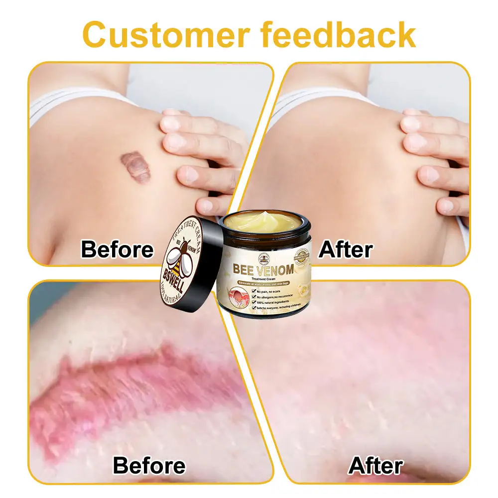 Bee Venom Skin Treatment Cream - Image 6