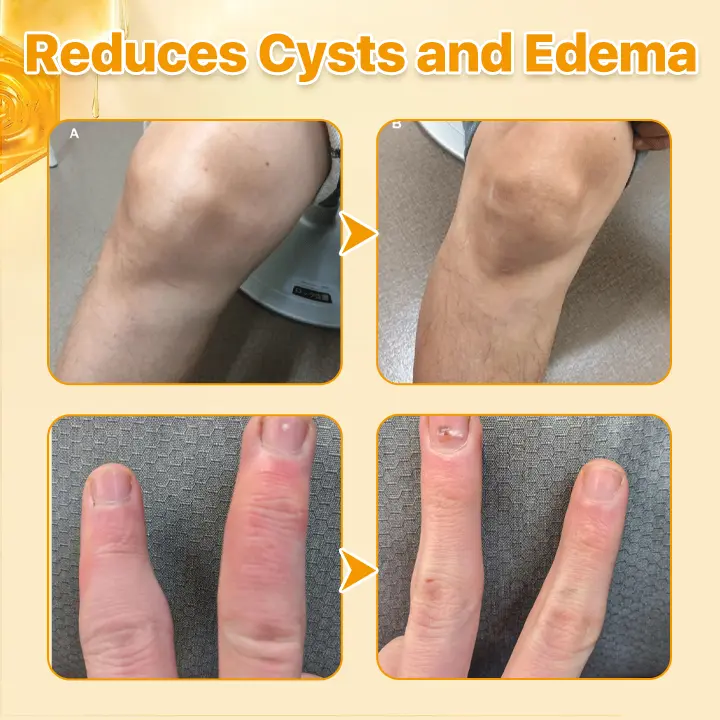 Bee Venom Joint Pain Relief & Healing Cream - Image 4