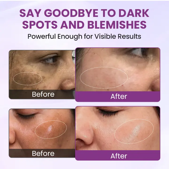 RadiantClear Blemish & Brightening Serum - Image 8