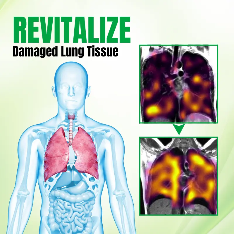RespiPure Herbal Lung Detox Spray - Image 4