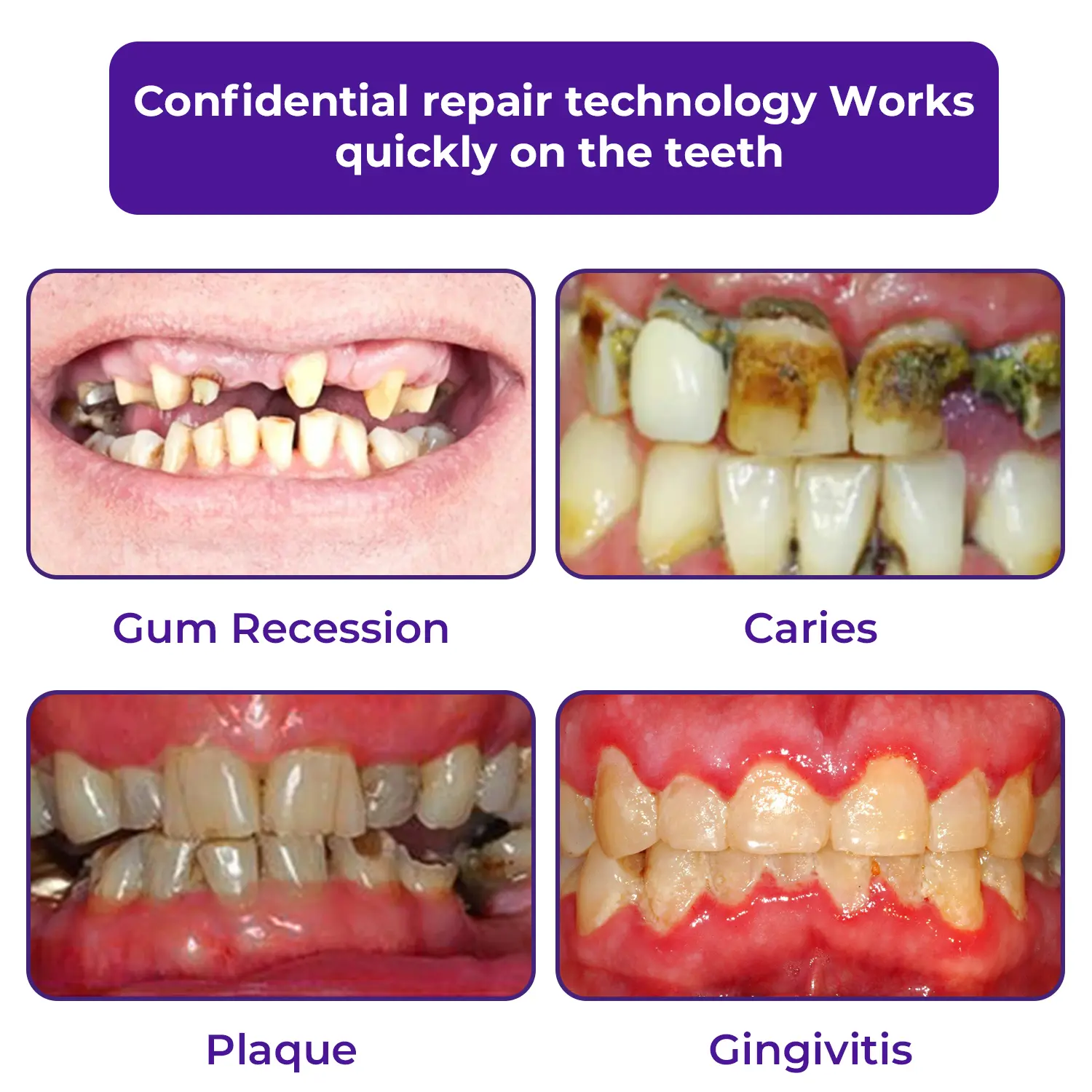 Dental Repair Mineral Powder - Image 2