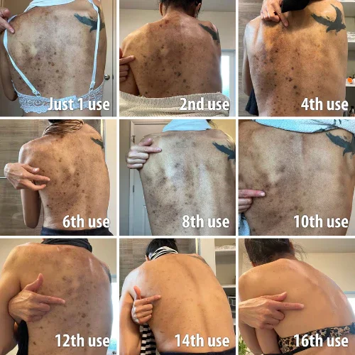 OceanCure Bee Venom Psoriasis & Wart Healing Cream - Image 2