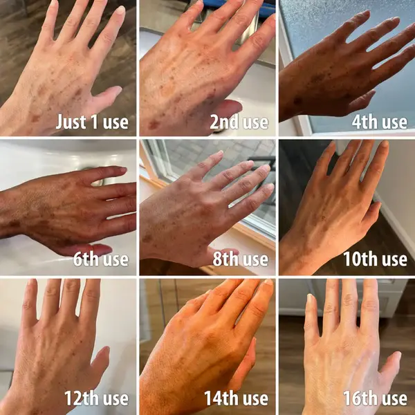 OceanCure Bee Venom Psoriasis & Wart Healing Cream - Image 3