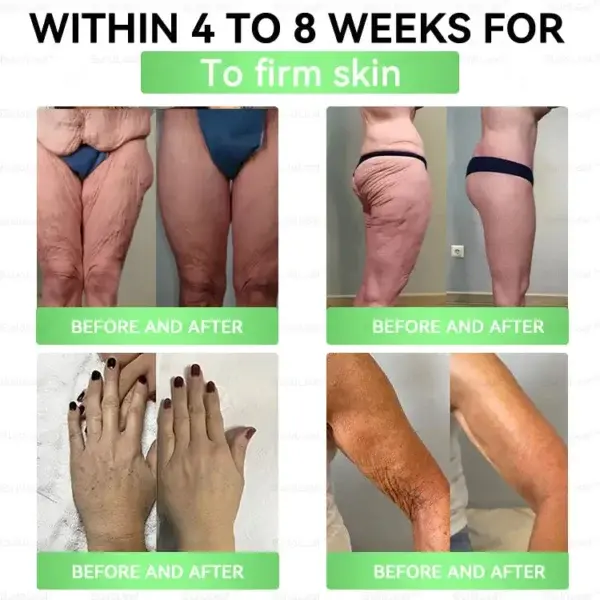 8-๐๐-1 ๐๐๐ฉ & ๐๐๐ฉ๐๐ก ๐ฎ๐๐บ๐
๐๐ค๐ก๐ช๐ฉ๐๐ค๐ฃ - Image 8