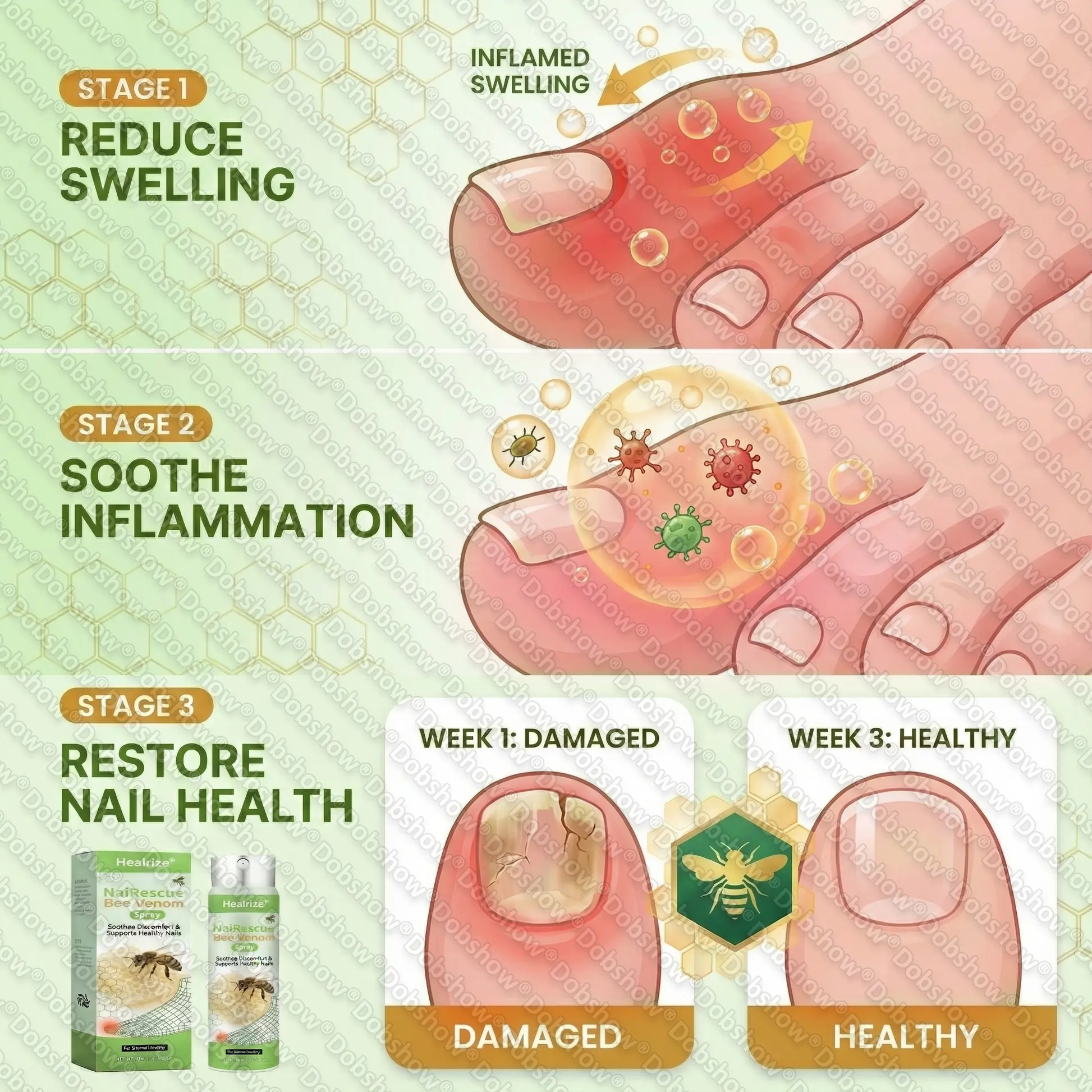 NailRescue Bee Venom Spray - Image 7