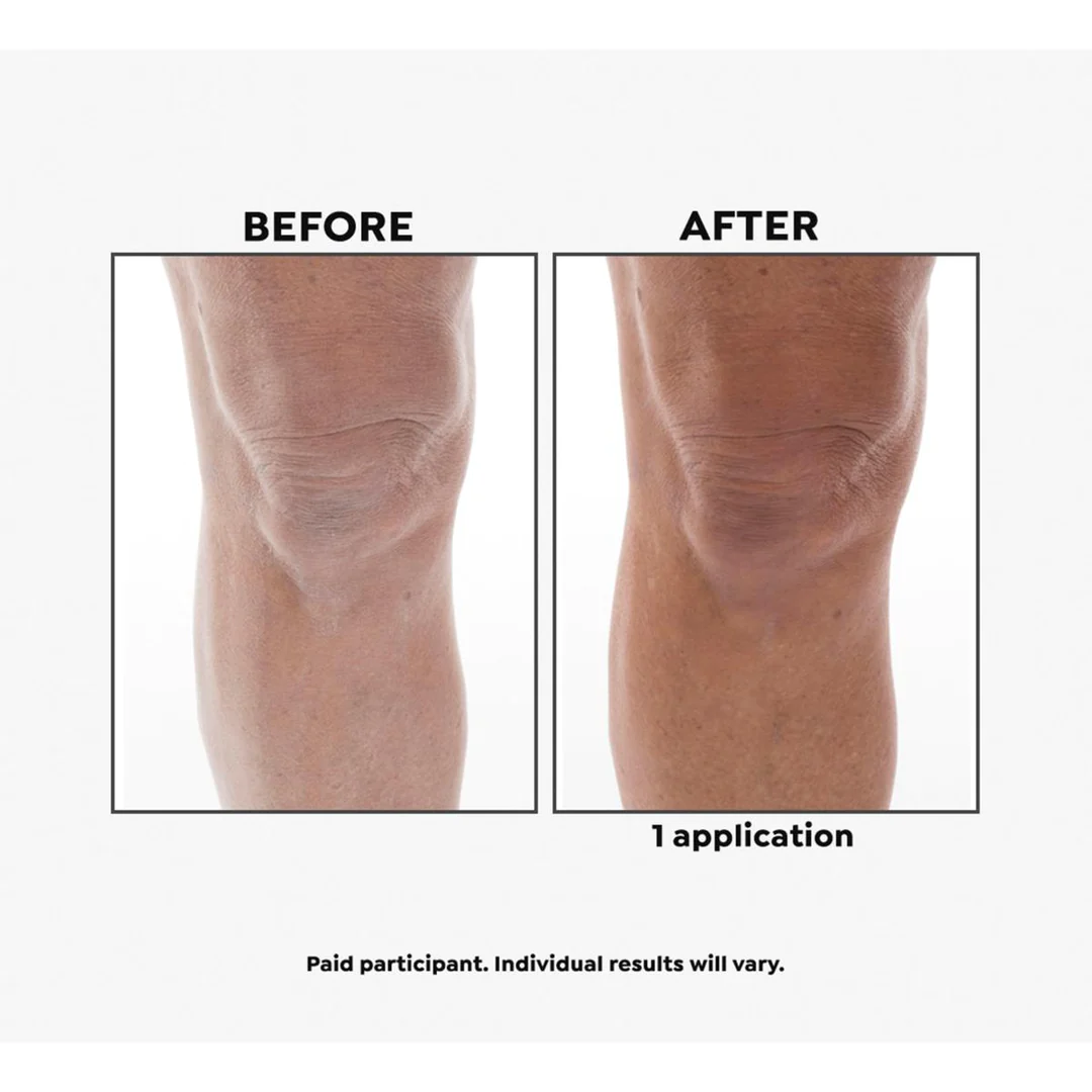 Imperial Honey Deluxe 2-piece Kit - Image 3