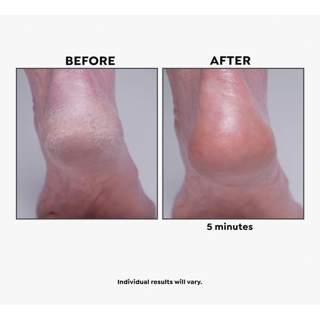 Imperial Honey Deluxe 2-piece Kit - Image 2