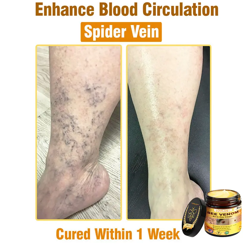 Bee Venom All-in-One Cream - Image 4