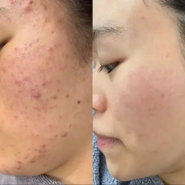 Facial Cream with 7% Arbutin + 4% Tranexamic Acid - Image 2