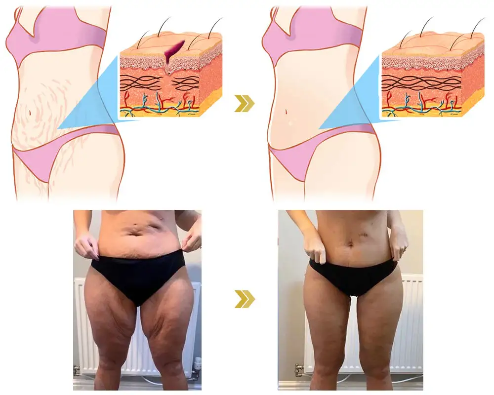 ๐๐๐ฏ๐๐ง๐๐๐ ๐
๐ข๐ซ๐ฆ๐ข๐ง๐ & ๐๐ซ๐ข๐ง๐ค๐ฅ๐-๐๐๐๐ฎ๐๐ข๐ง๐ ๐๐ซ๐๐๐ฆ - Image 6