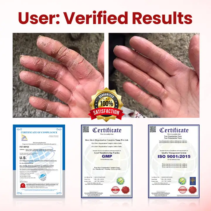 VitaGluco Diabetic Care Cream - Image 6