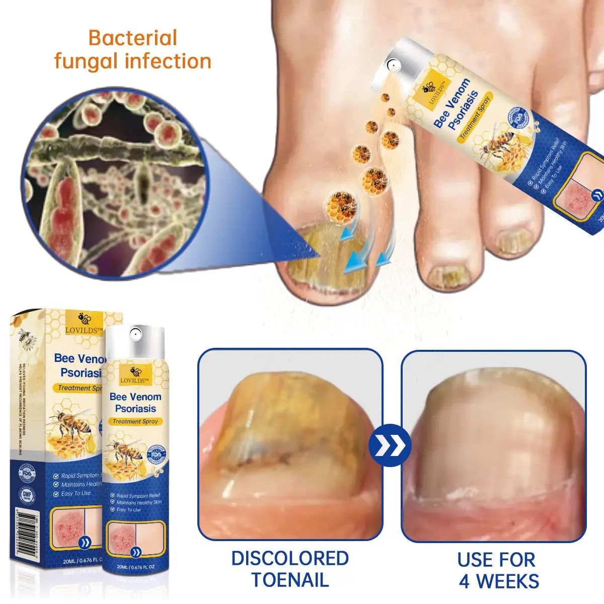 PsoriaHeal Bee Venom Psoriasis Treatment Spray - Image 5