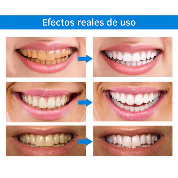 Esencia blanqueadora de dientes - Image 9