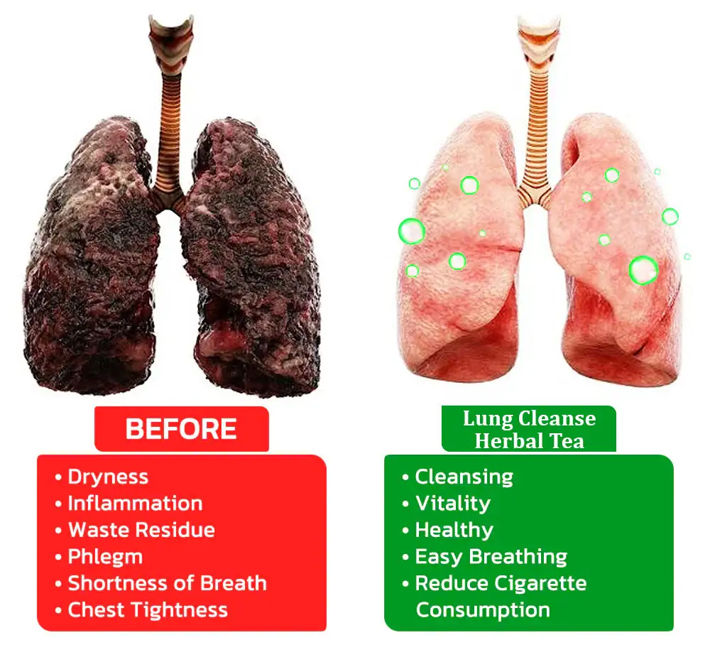 MULLEIN Natural Herbal Tea For Lung Cleanse And Respiratory Support - Image 8